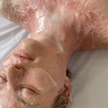 DMK Enzyme Therapy Treatment