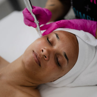 Microneedling