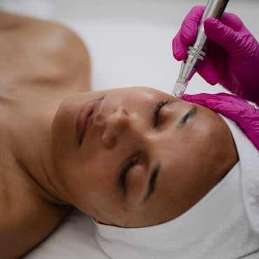 Microneedling Scar Add-On