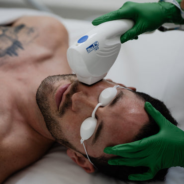 IPL Acne Facial