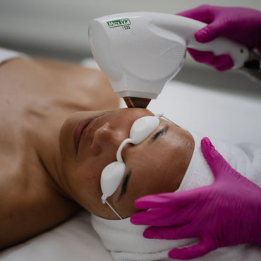 IPL Photorejuvenation Treatment