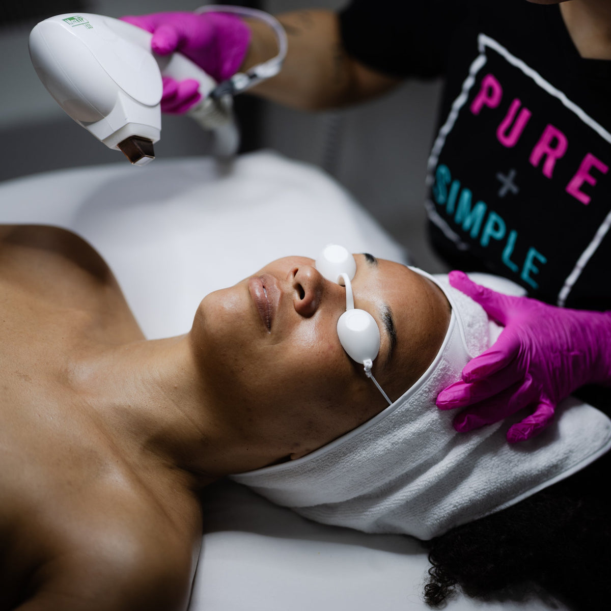 IPL Correct: Pigmentation