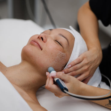 Classic Microdermabrasion Add-On