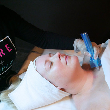 Microneedling Décolleté Add-On