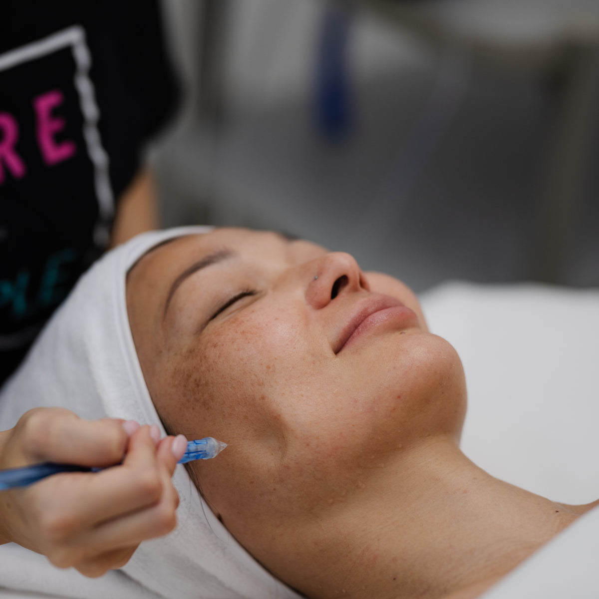 Aquabrasion Facial