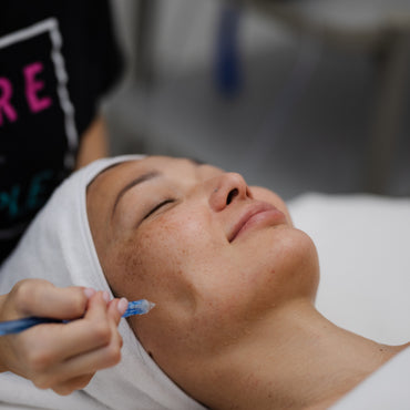 Aquabrasion Facial
