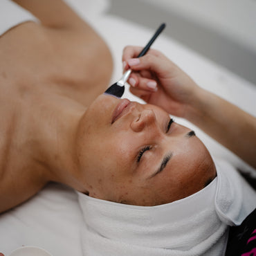 Professional Strength Lactic Acid Peel Add-On
