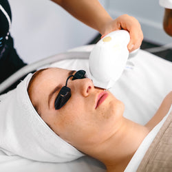 IPL Photorejuvenation Treatment