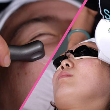 Photodermabrasion